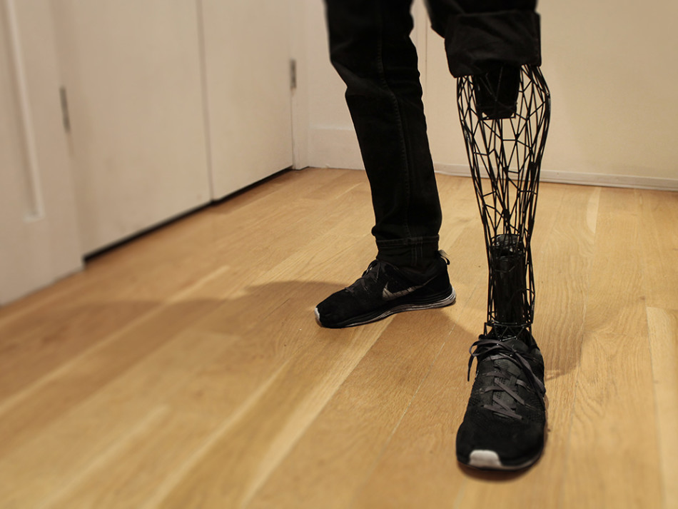 科幻成真：3D打印假肢功能强大时尚感十足