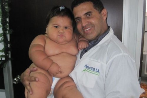 哥伦比亚10个月大女婴体重已达20公斤 堪比5岁孩童