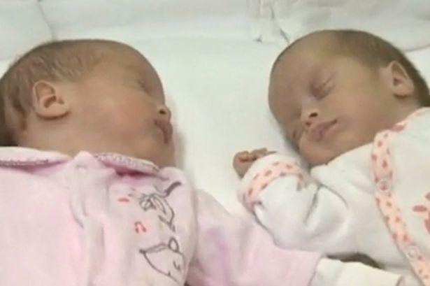 罗马尼亚一对双胞胎女婴 出生日期相隔2月