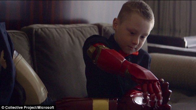 7岁男童手臂发育不全 钢铁侠亲赠同款仿生手臂