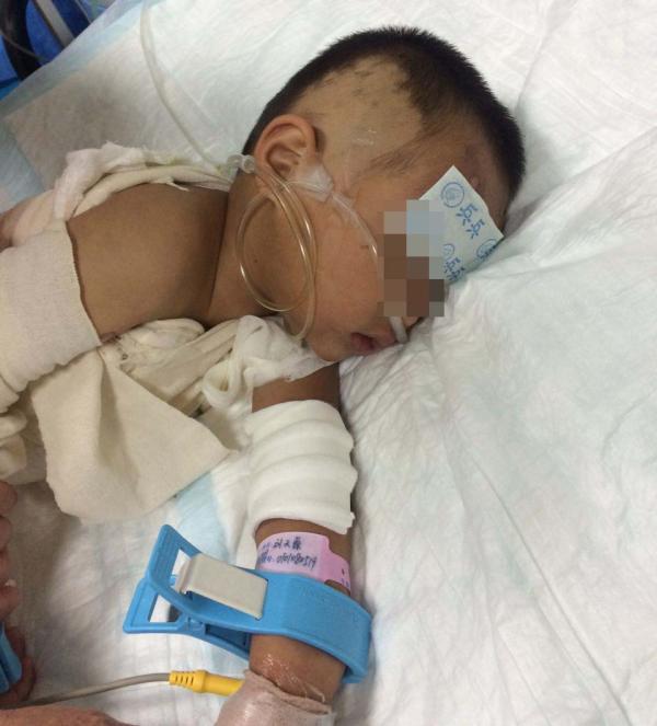2岁男童养老院遭烫伤：母亲吸毒 父亲不闻不问