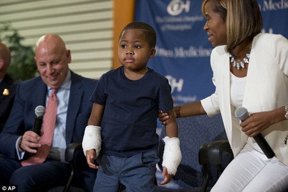 美8岁男孩成功接受移植双手手术 全球最年轻
