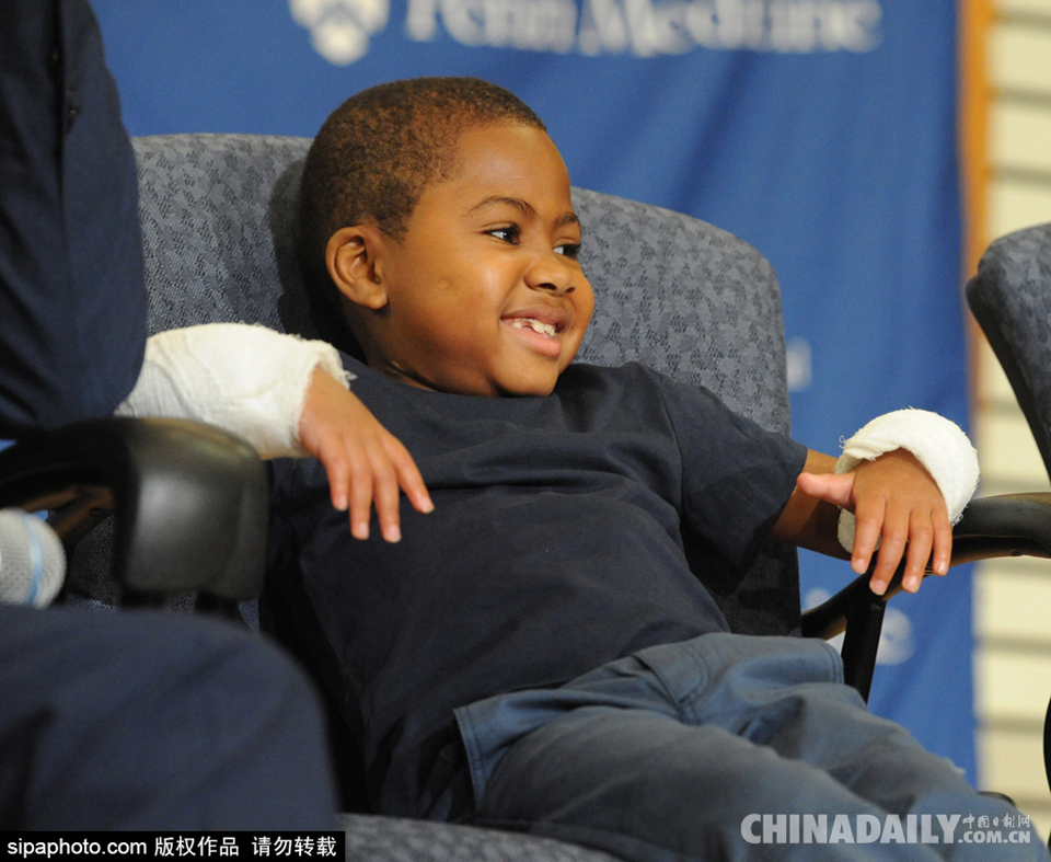 美8岁男孩成功移植双手 成世界首位接受该手术的儿童