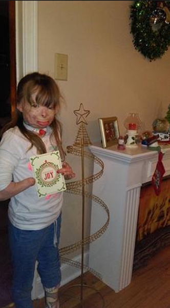 美8岁烧伤女孩圣诞梦圆：世界各地陌生人寄来温馨礼物