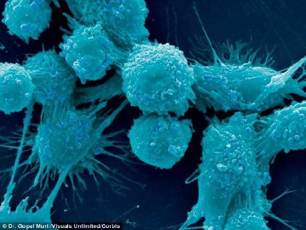 22种癌症系基因遗传 兄妹患癌风险增加33%