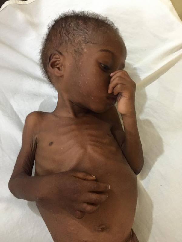 尼日利亚千名皮包骨“巫童”遭抛弃 非洲儿童基金会施援手